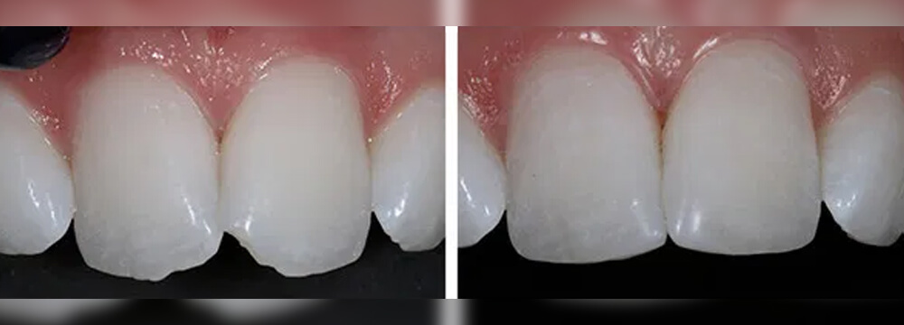 country-oaks-dental-01