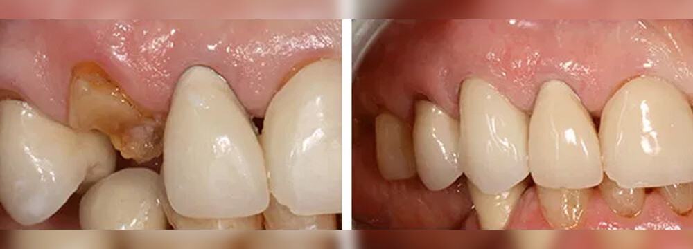country-oaks-dental-02