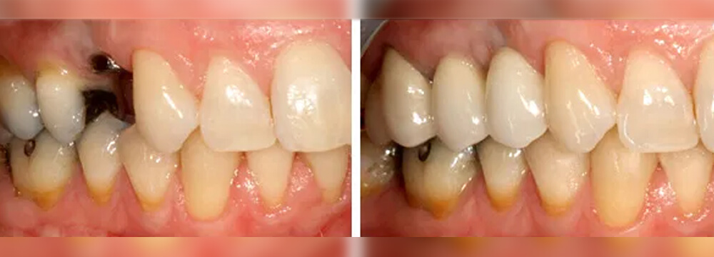 country-oaks-dental-05
