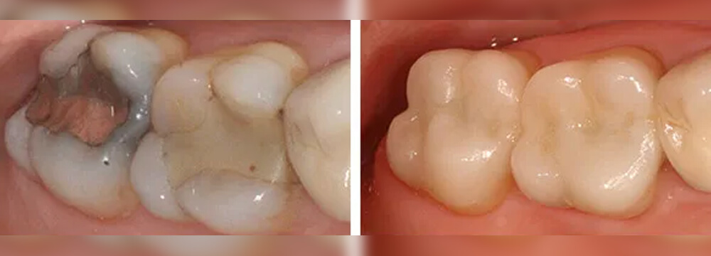 country-oaks-dental-07