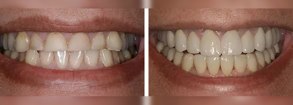 country-oaks-dental-08